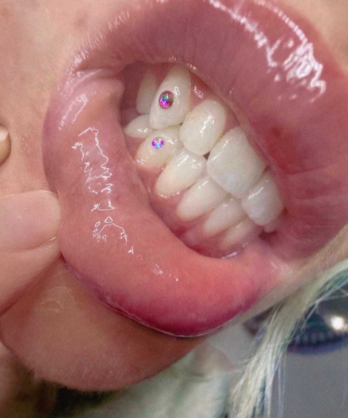 Teeth with colorful rhinestones on white surface, lips pulled back to reveal the jewelry.